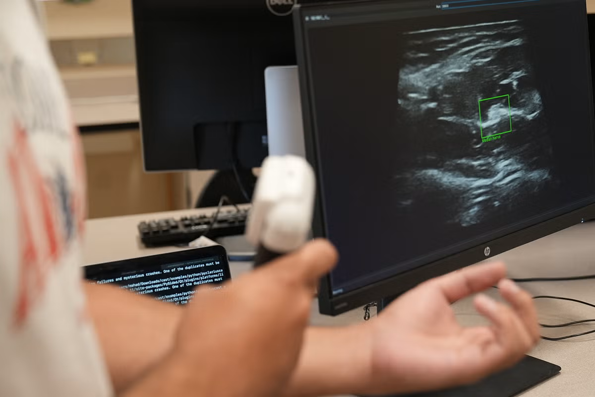 handheld ultrasound device